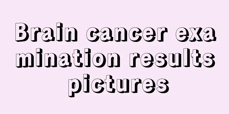 Brain cancer examination results pictures