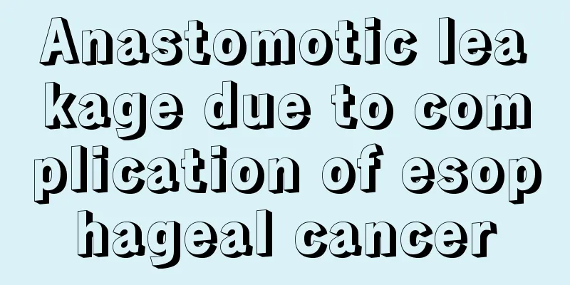 Anastomotic leakage due to complication of esophageal cancer