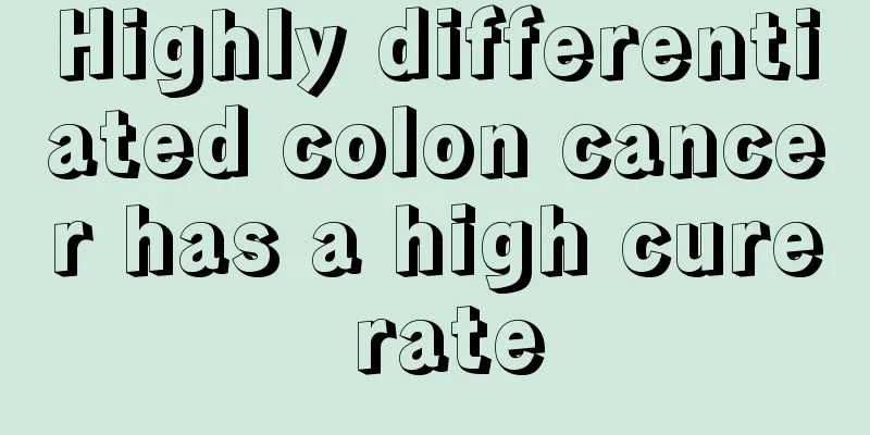 Highly differentiated colon cancer has a high cure rate