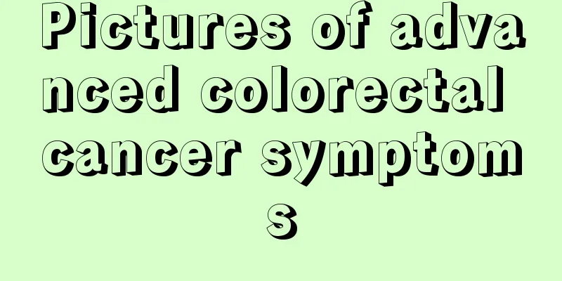 Pictures of advanced colorectal cancer symptoms