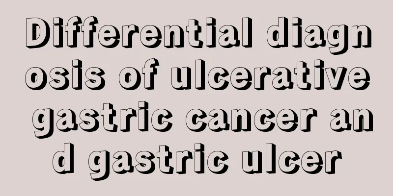 Differential diagnosis of ulcerative gastric cancer and gastric ulcer