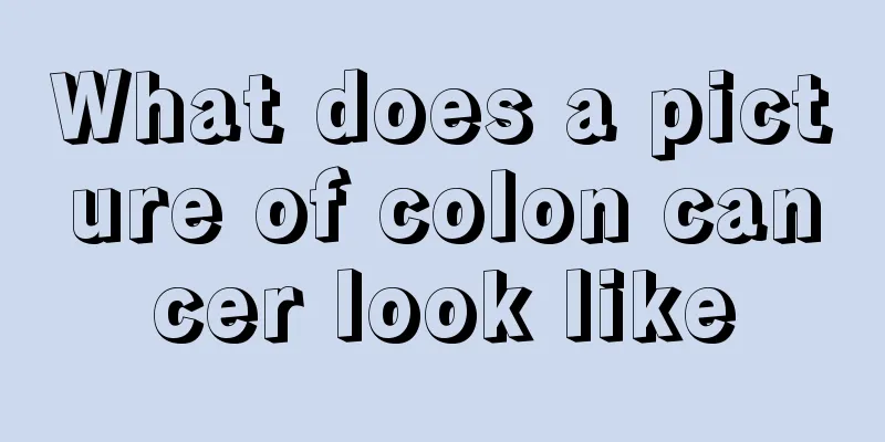 What does a picture of colon cancer look like