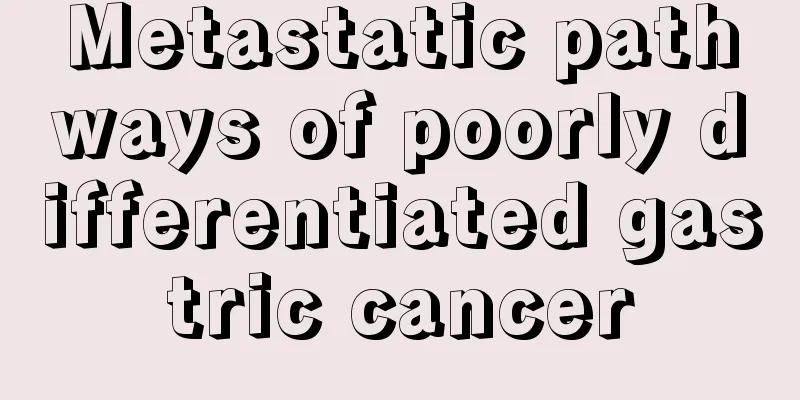 Metastatic pathways of poorly differentiated gastric cancer