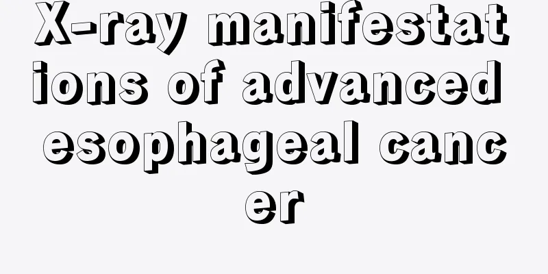 X-ray manifestations of advanced esophageal cancer