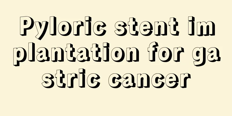 Pyloric stent implantation for gastric cancer