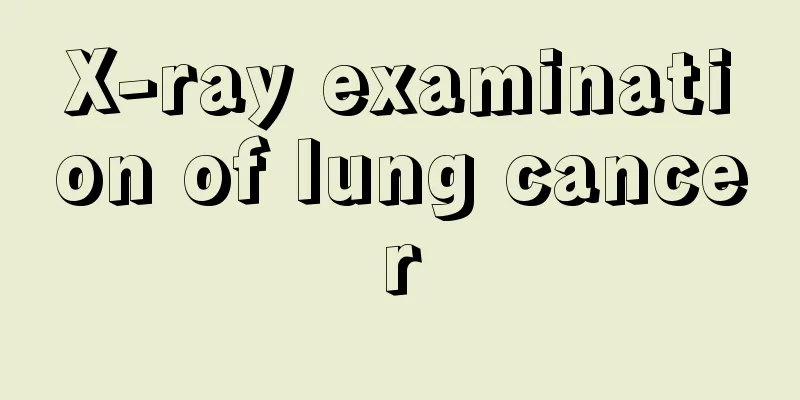 X-ray examination of lung cancer