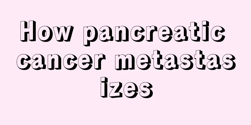 How pancreatic cancer metastasizes