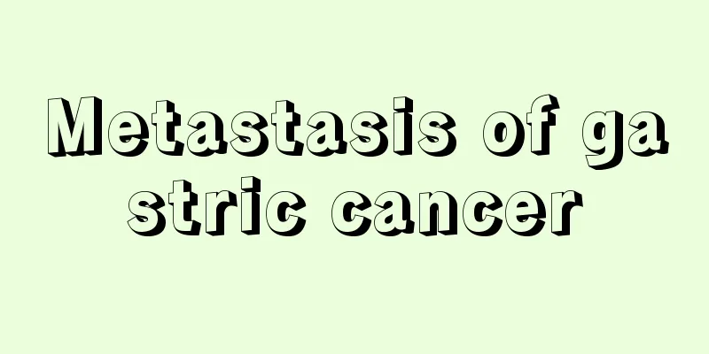 Metastasis of gastric cancer