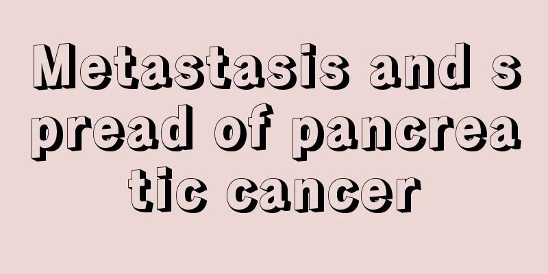 Metastasis and spread of pancreatic cancer
