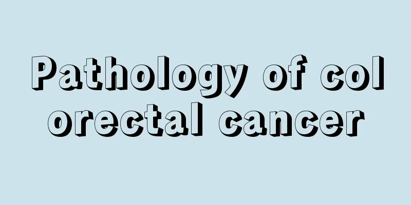 Pathology of colorectal cancer