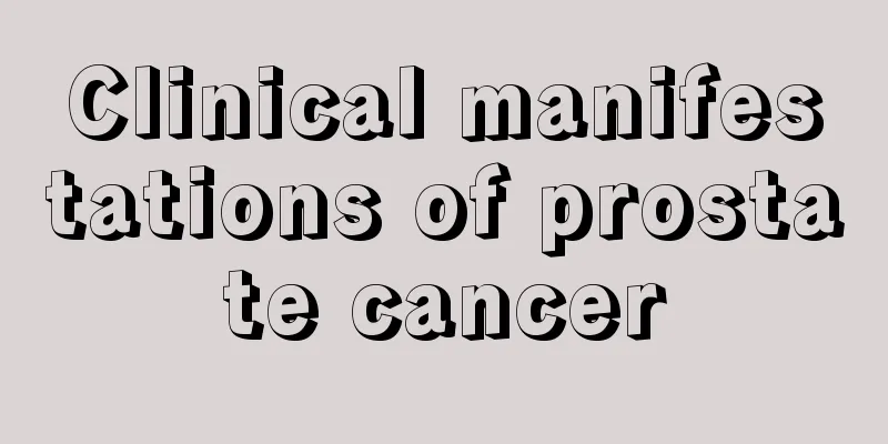 Clinical manifestations of prostate cancer