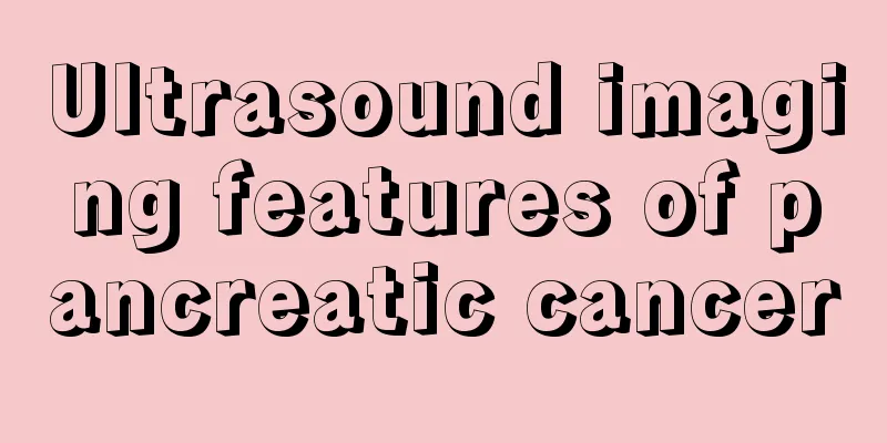 Ultrasound imaging features of pancreatic cancer