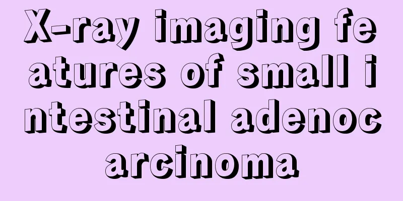 X-ray imaging features of small intestinal adenocarcinoma