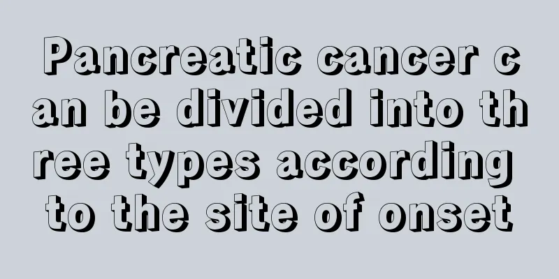 Pancreatic cancer can be divided into three types according to the site of onset