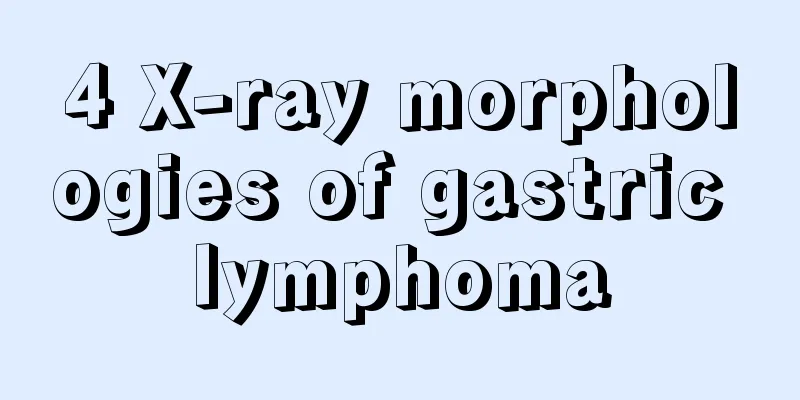 4 X-ray morphologies of gastric lymphoma