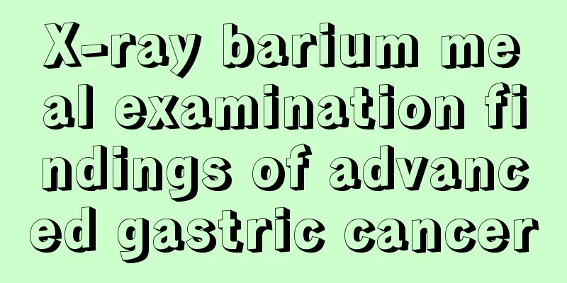 X-ray barium meal examination findings of advanced gastric cancer