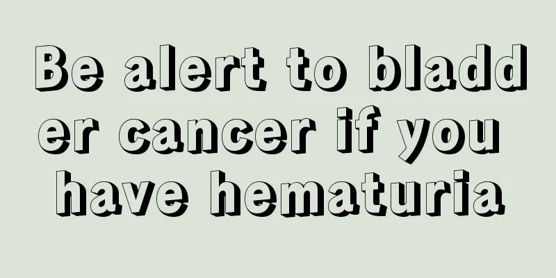 Be alert to bladder cancer if you have hematuria