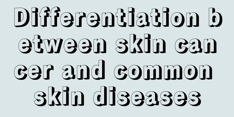 Differentiation between skin cancer and common skin diseases