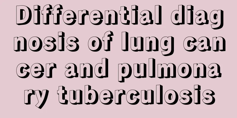 Differential diagnosis of lung cancer and pulmonary tuberculosis