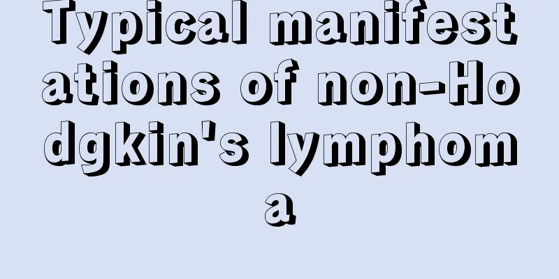 Typical manifestations of non-Hodgkin's lymphoma