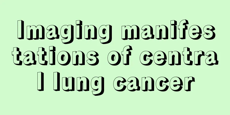 Imaging manifestations of central lung cancer