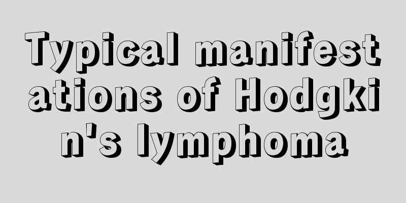 Typical manifestations of Hodgkin's lymphoma