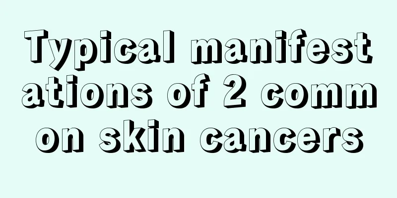 Typical manifestations of 2 common skin cancers