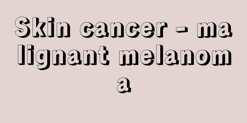 Skin cancer - malignant melanoma