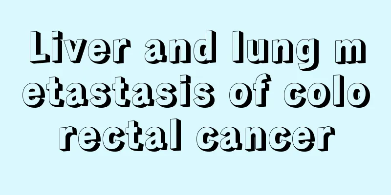Liver and lung metastasis of colorectal cancer
