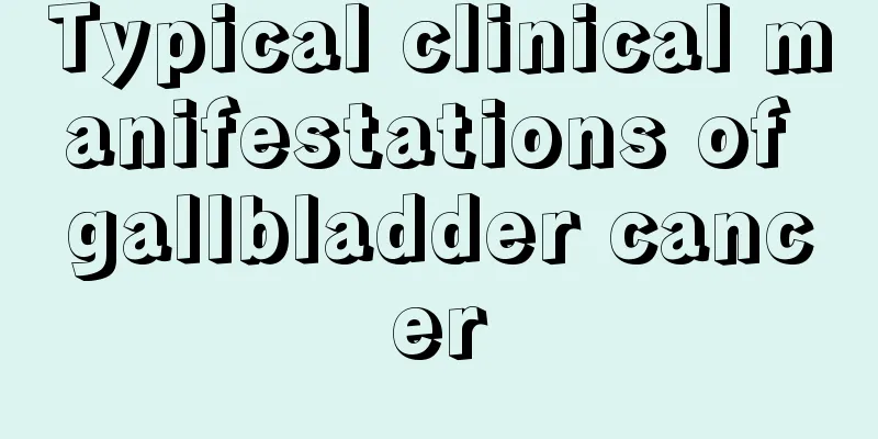 Typical clinical manifestations of gallbladder cancer