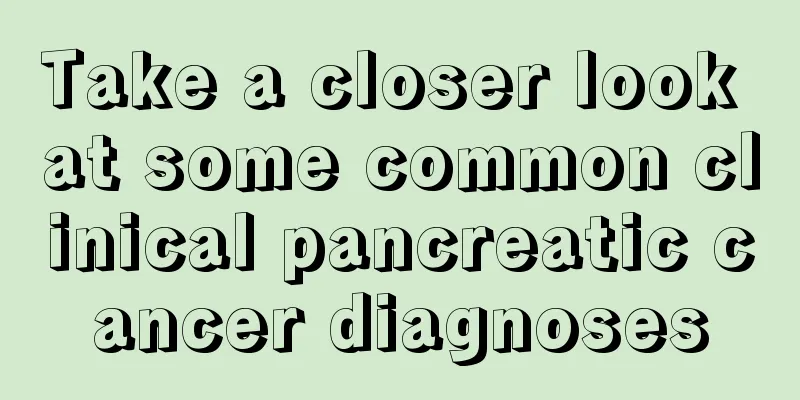Take a closer look at some common clinical pancreatic cancer diagnoses
