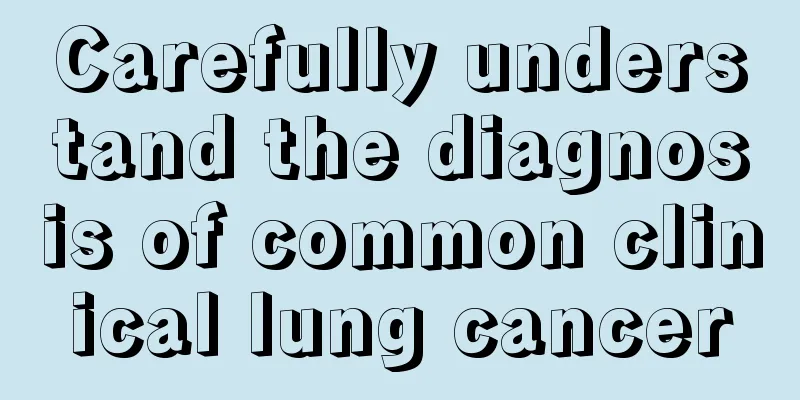 Carefully understand the diagnosis of common clinical lung cancer