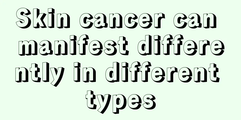 Skin cancer can manifest differently in different types