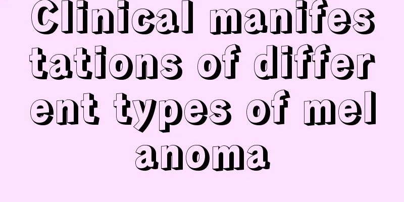Clinical manifestations of different types of melanoma