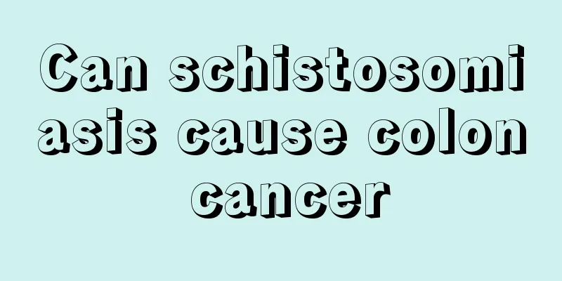 Can schistosomiasis cause colon cancer