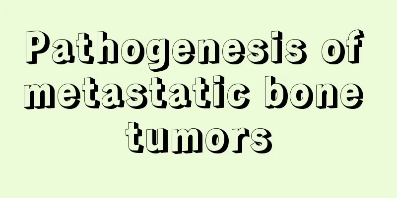 Pathogenesis of metastatic bone tumors